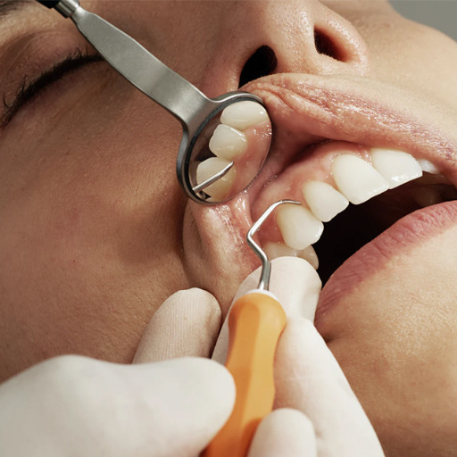 Imagem ilustrativa do curso de A Odontologia no Tratamento de Pacientes com Transtorno Mental
